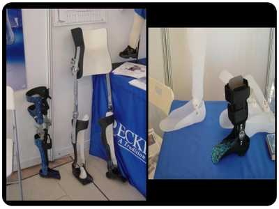 假肢與矯形器 功能、技術與應用概述