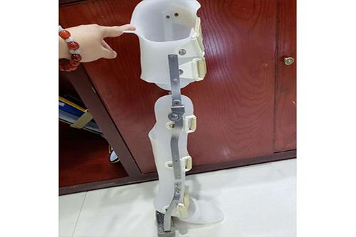 假肢與矯形器的使用周期與更換指南 科學(xué)維護(hù)，保障生活品質(zhì)